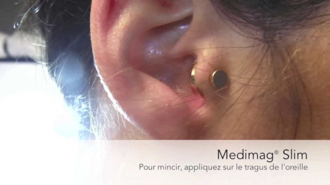 découvrez comment l'agrafe oreille peut vous aider à atteindre vos objectifs de perte de poids. cette méthode innovante stimule des points spécifiques pour favoriser la réduction de l'appétit et améliorer votre bien-être général. explorez les avantages et témoignez des témoignages inspirants de ceux qui ont réussi grâce à cette technique!