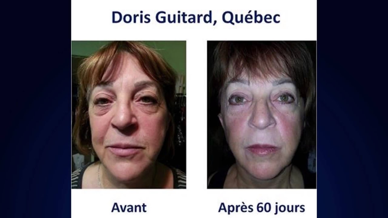 découvrez comment perdre 35 kilos et transformer votre vie grâce à des conseils pratiques, des recettes saines et des programmes d'entraînement adaptés. reprenez le contrôle de votre santé et atteignez vos objectifs de poids de manière durable.